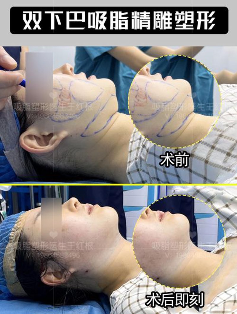 美莱整形：引领行业新风尚